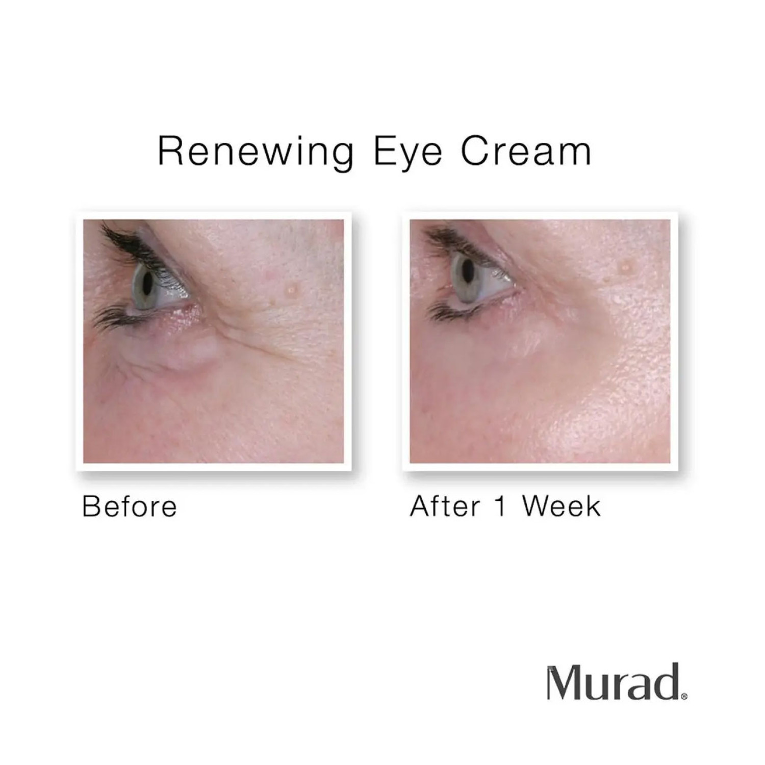 کرم نوسازی دور چشم رتینول دکتر مورد Murad Renewing Eye Cream حجم 15 میلی لیتر