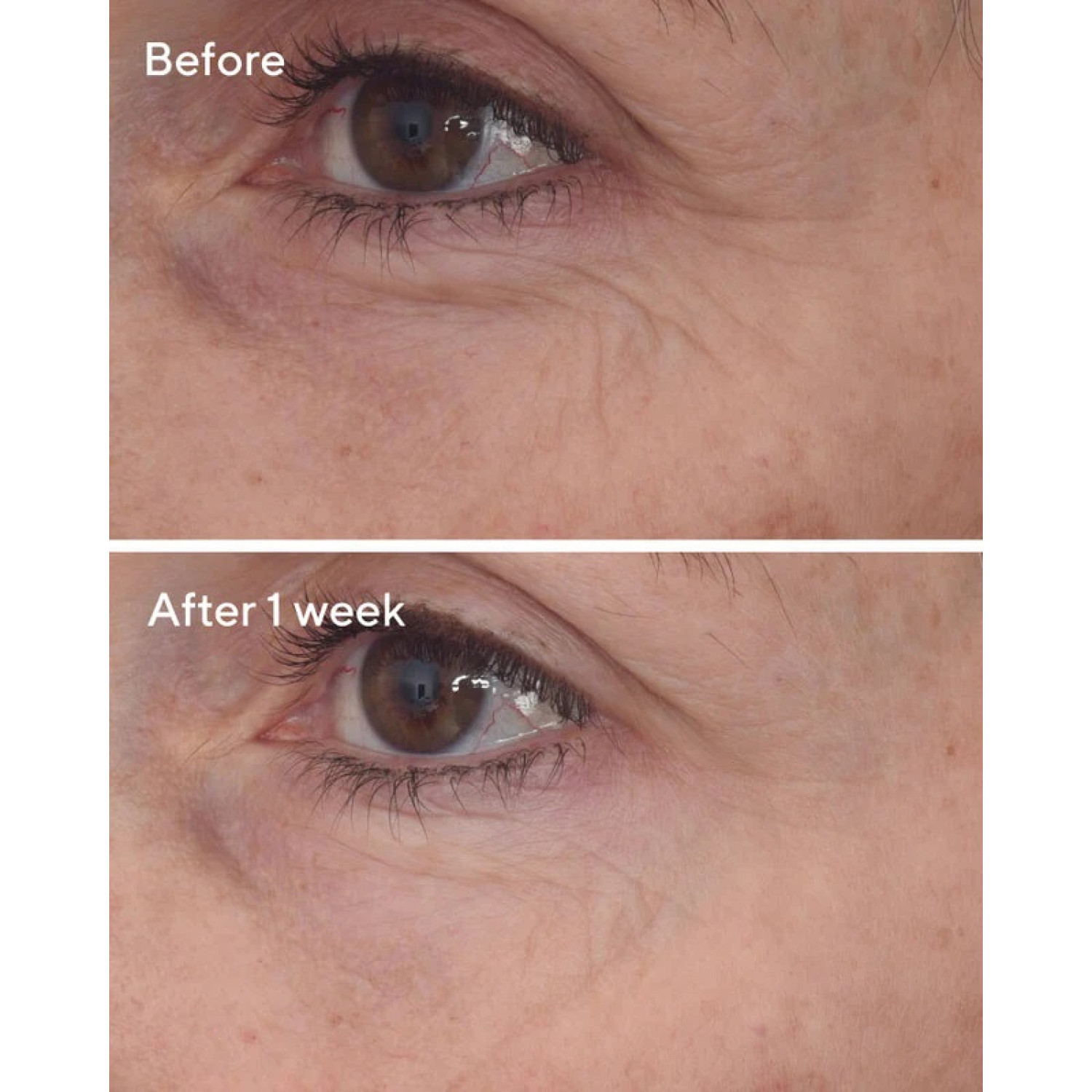 کرم ضد چروک و لیفتینگ دور چشم رتینول دکتر مورد Murad Retinal ReSculpt حجم 15 میلی لیتر کرم ضد چروک و لیفتینگ دور چشم رتینول دکتر مورد Murad Retinal ReSculpt حجم 15 میلی لیتر