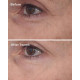 کرم ضد چروک و لیفتینگ دور چشم رتینول دکتر مورد Murad Retinal ReSculpt حجم 15 میلی لیتر کرم ضد چروک و لیفتینگ دور چشم رتینول دکتر مورد Murad Retinal ReSculpt حجم 15 میلی لیتر