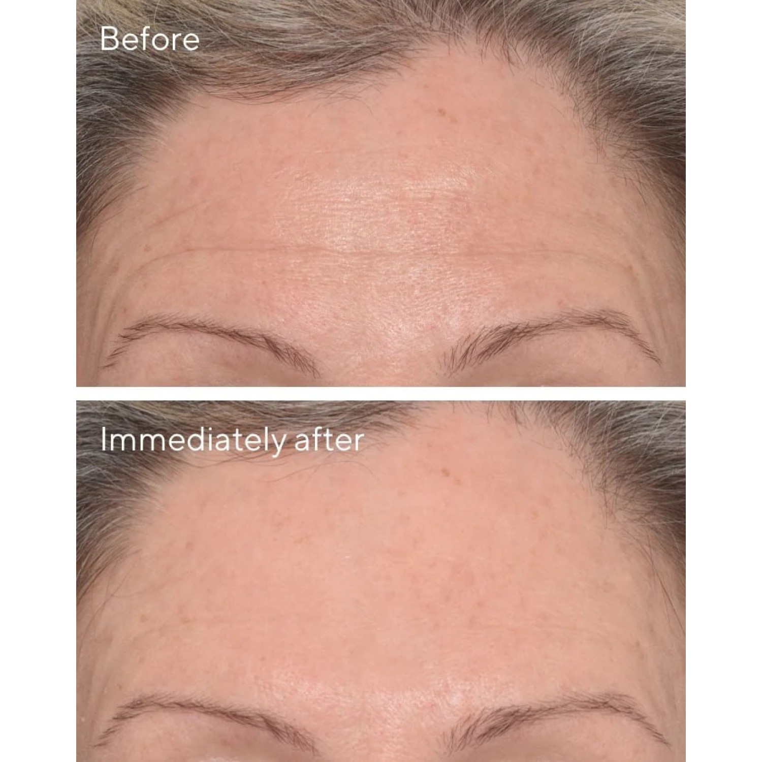 کرم پر کننده خطوط دکتر مورد Murad Targeted Wrinkle Corrector حجم 15 میلی لیتر کرم پر کننده خطوط دکتر مورد Murad Targeted Wrinkle Corrector حجم 15 میلی لیتر