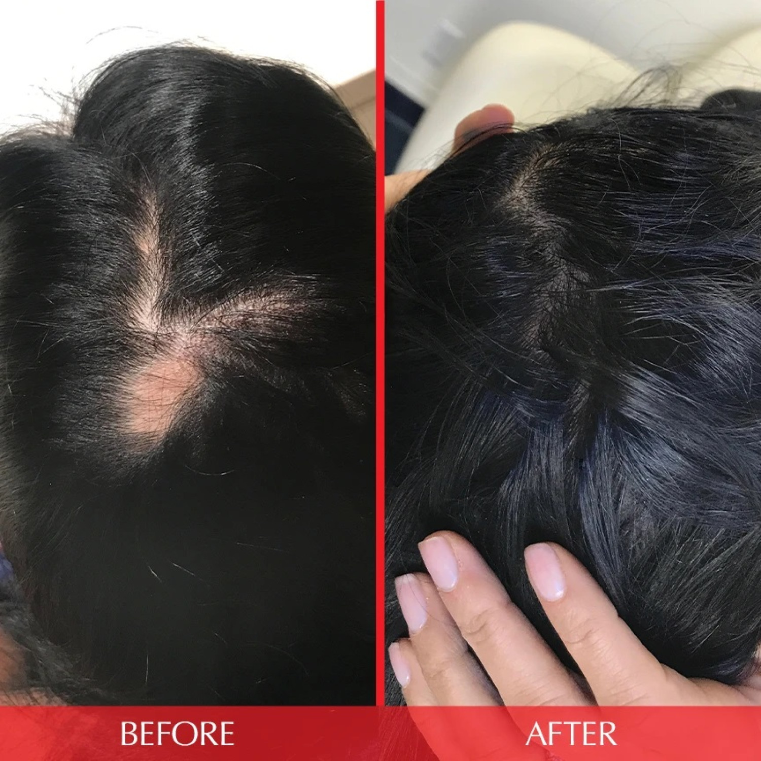 مکمل مولتی ویتامین تقویت موی هیرتامین Hairtamin Advanced Formula تعداد 30 عدد مکمل مولتی ویتامین تقویت موی هیرتامین Hairtamin Advanced Formula تعداد 30 عدد