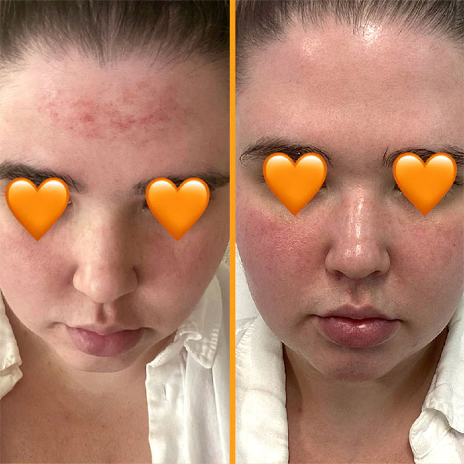 مکمل بهبود سلامت پوست اسکین تامین SkinTamin Collagen تعداد 30 عدد مکمل بهبود سلامت پوست اسکین تامین SkinTamin Collagen تعداد 30 عدد