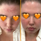 مکمل بهبود سلامت پوست اسکین تامین SkinTamin Collagen تعداد 30 عدد مکمل بهبود سلامت پوست اسکین تامین SkinTamin Collagen تعداد 30 عدد