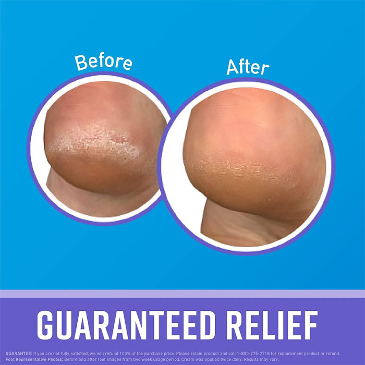 کرم شب ترمیم کننده قوی ترک پای اوکیفس OKeeffes Healthy Feet Night وزن 85 گرم کرم شب ترمیم کننده قوی ترک پای اوکیفس OKeeffes Healthy Feet Night وزن 85 گرم
