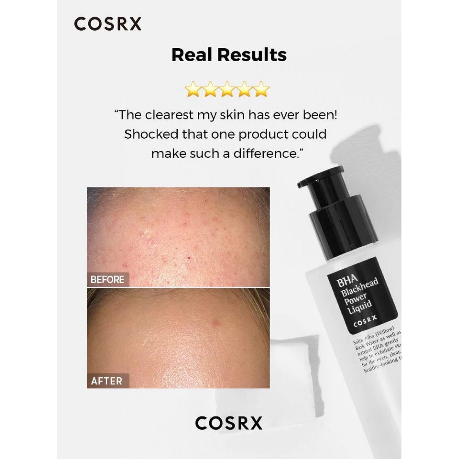 تونر لایه بردار و پاکسازی جوش سر سیاه کوزارکس Cosrx BHA حجم 100 میلی لیتر تونر لایه بردار و پاکسازی جوش سر سیاه کوزارکس Cosrx BHA حجم 100 میلی لیتر